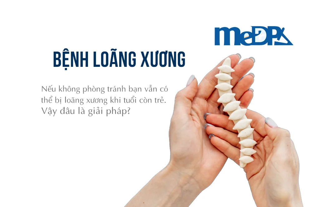 medpadiag-tam-soat-loang-xuong