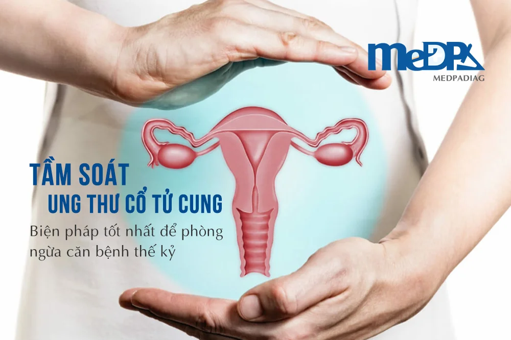 medpadiag-tam-soat-ung-thu-co-tu-cung-dinh-ky