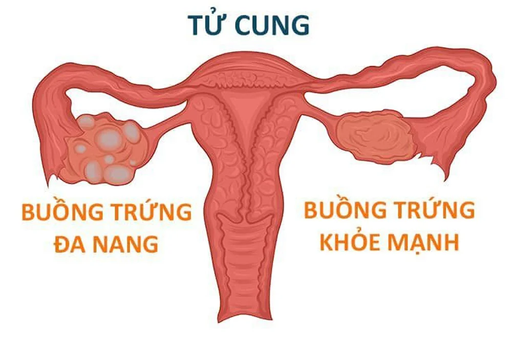 medpadiag-da-nang-buong-trung