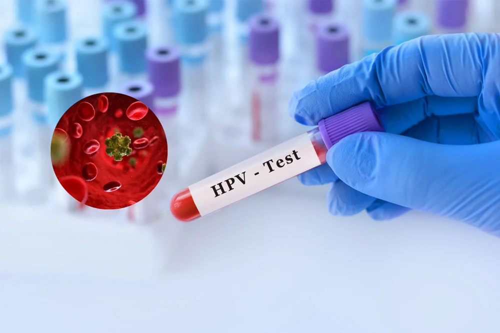 medpadiag-xet-nghiem-hpv-genotype