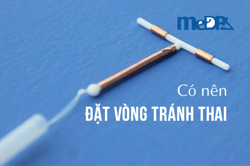 medpadiag-dat-vong-tranh-thai.