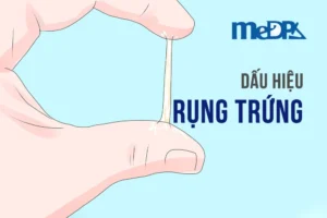 medpadiag-dau-hieu-rung-trung