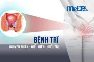 medpadiag-benh-tri-nguyen-nhan-bieu-hien