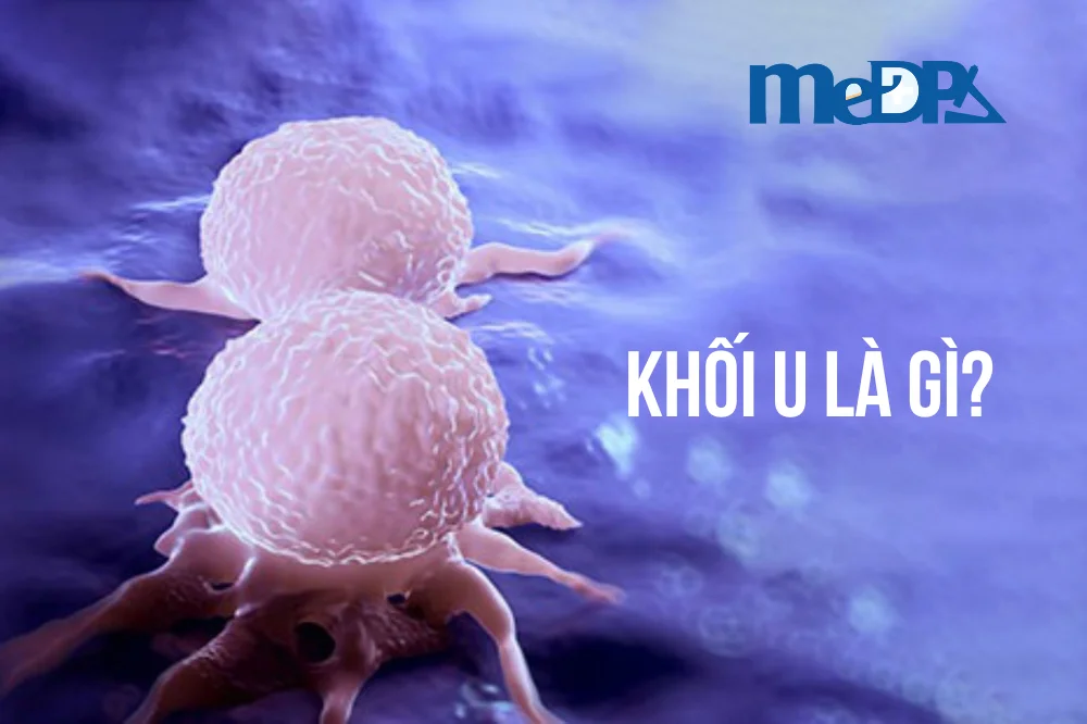medpadiag-khoi-u-la-gi