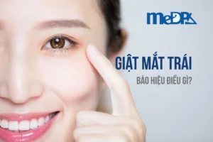 medpadiag-mat-trai-giat-bao-hieu-dieu-gi