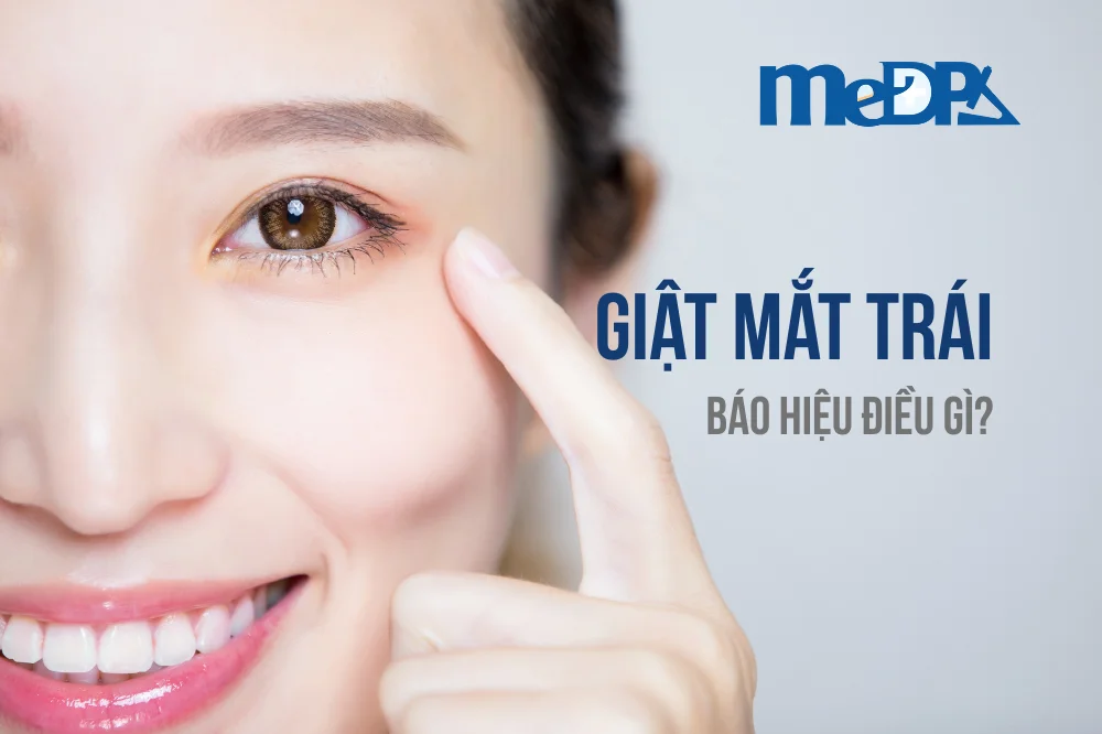 medpadiag-mat-trai-giat-bao-hieu-dieu-gi