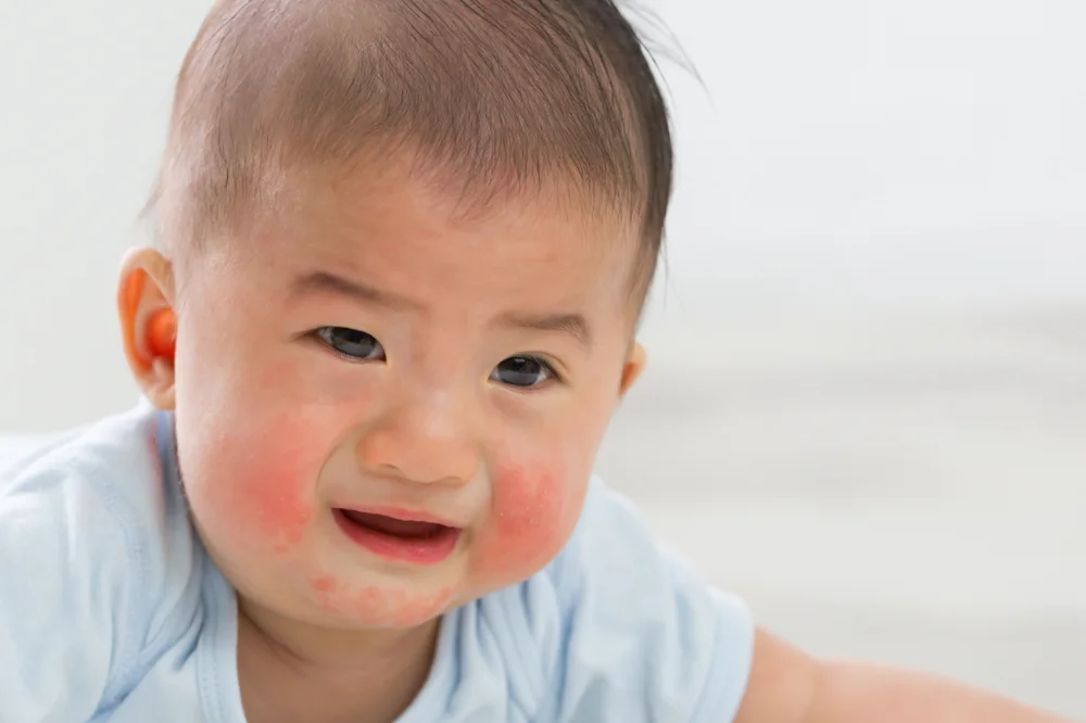 medpadiag-noi-me-day-nguyen-nhan-cach-dieu-tri