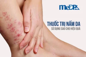 medpadiag-thuoc-tri-nam-da-mat