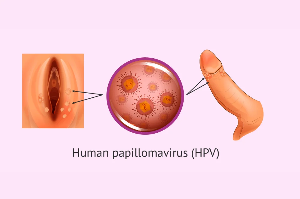medpadiag-hpv-la-gi-xet-nghiem-hpv