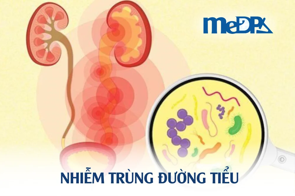 medpadiag-nhiem-trung-duong-tieu