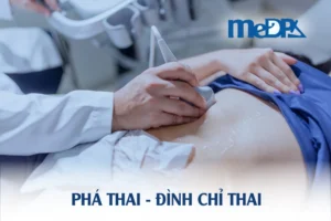 medpadiag-pha-thai-dinh-chi-thai