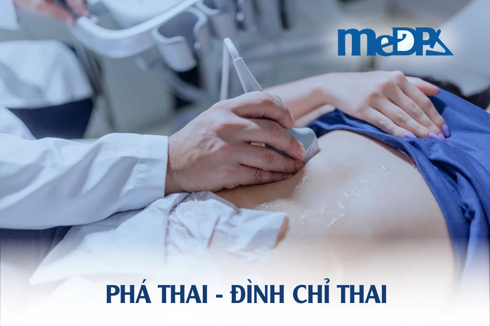 medpadiag-pha-thai-dinh-chi-thai