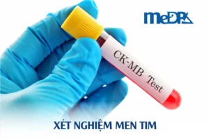 medpadiag-xet-nghiem-men-tim