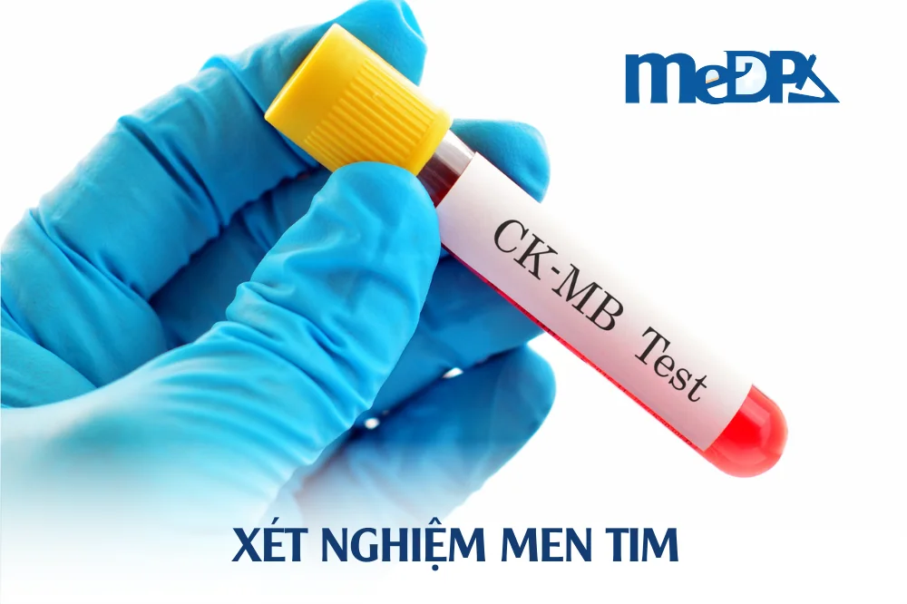 medpadiag-xet-nghiem-men-tim