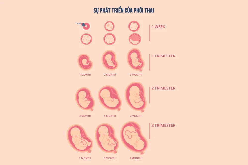 medpadiag-thai-ngoai-tu-cung-la-gi