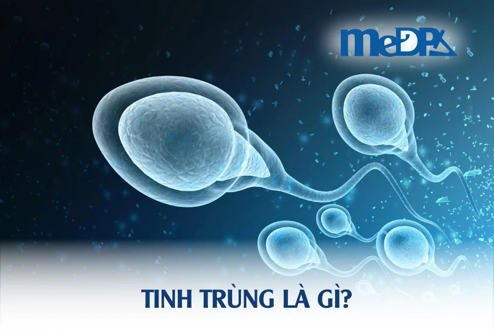 medpadiag-tinh-trung-la-gi