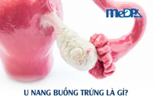 medpadiag-u-nang-buong-trung-la-gi
