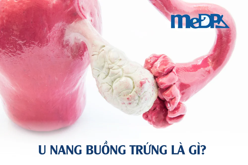 medpadiag-u-nang-buong-trung-la-gi