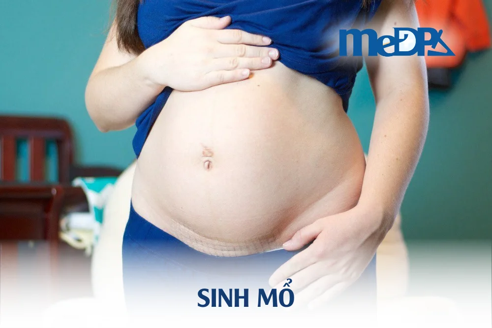 sinh-mo-la-gi-khi-nao-quan-he-lai-duoc