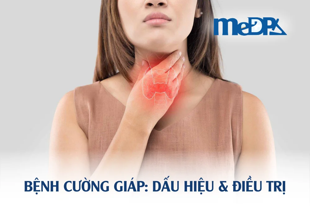 medpadiag-benh-cuong-giap-dau-hieu
