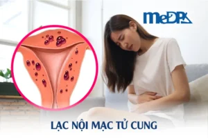 medpadiag-lac-noi-mac-tu-cung