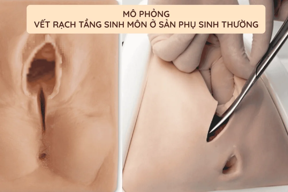 medpadiag-sinh-thuong-che-do-an-cho-me-o-cu