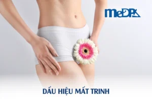 medpadiag-dau-hieu-mat-trinh
